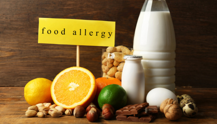 Food allergy signs, nuts, milk and oranges on a wooden table.
